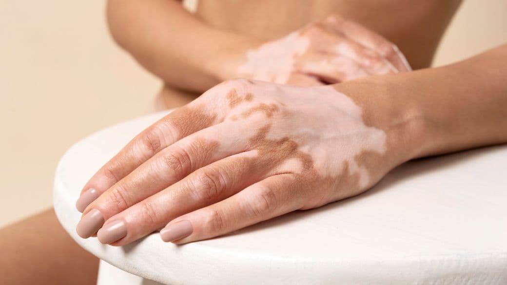 Cauze și factori de risc