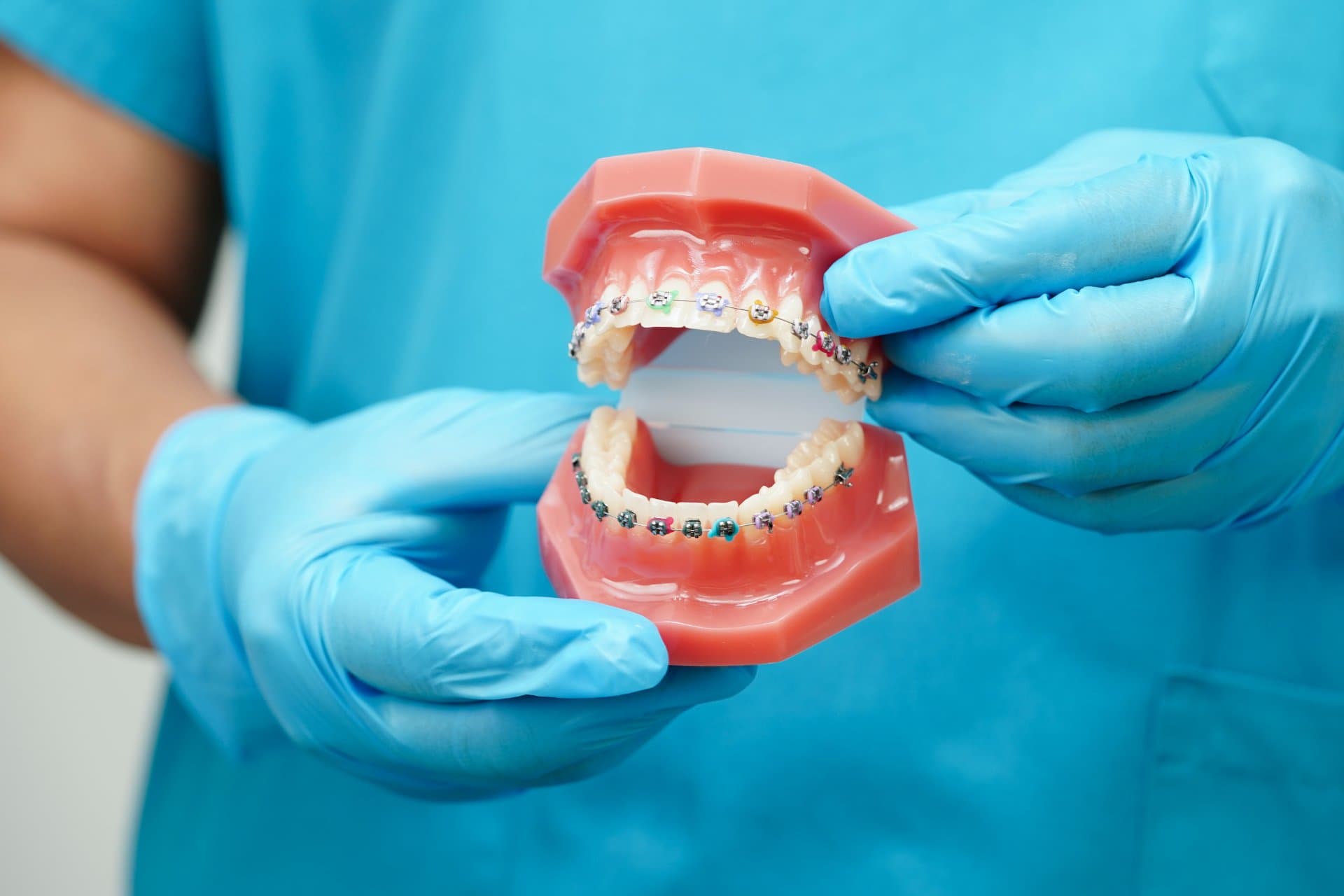 Abonament aparat dentar