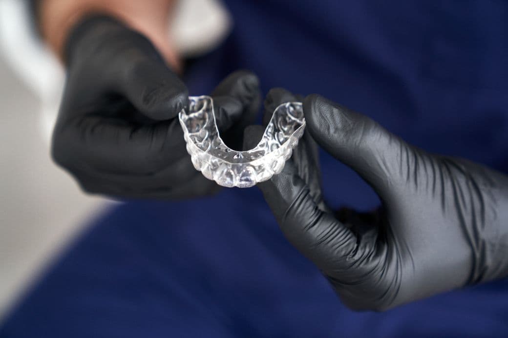 Ce sunt gutierele dentare?