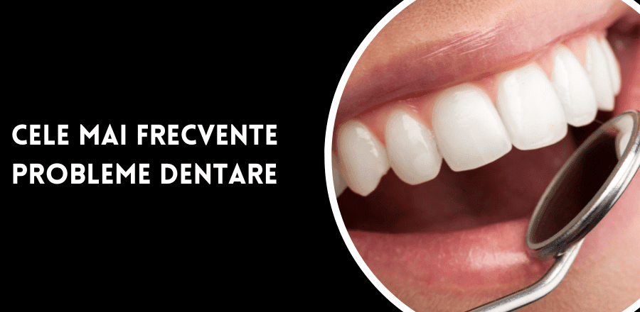 Cele mai frecvente probleme dentare